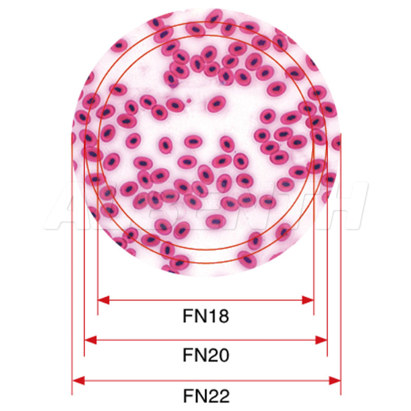 Albenth 40X-1000X Trinocular Infinity Plan Achromatic Compound Biological Microscope For Clinical Laboratory